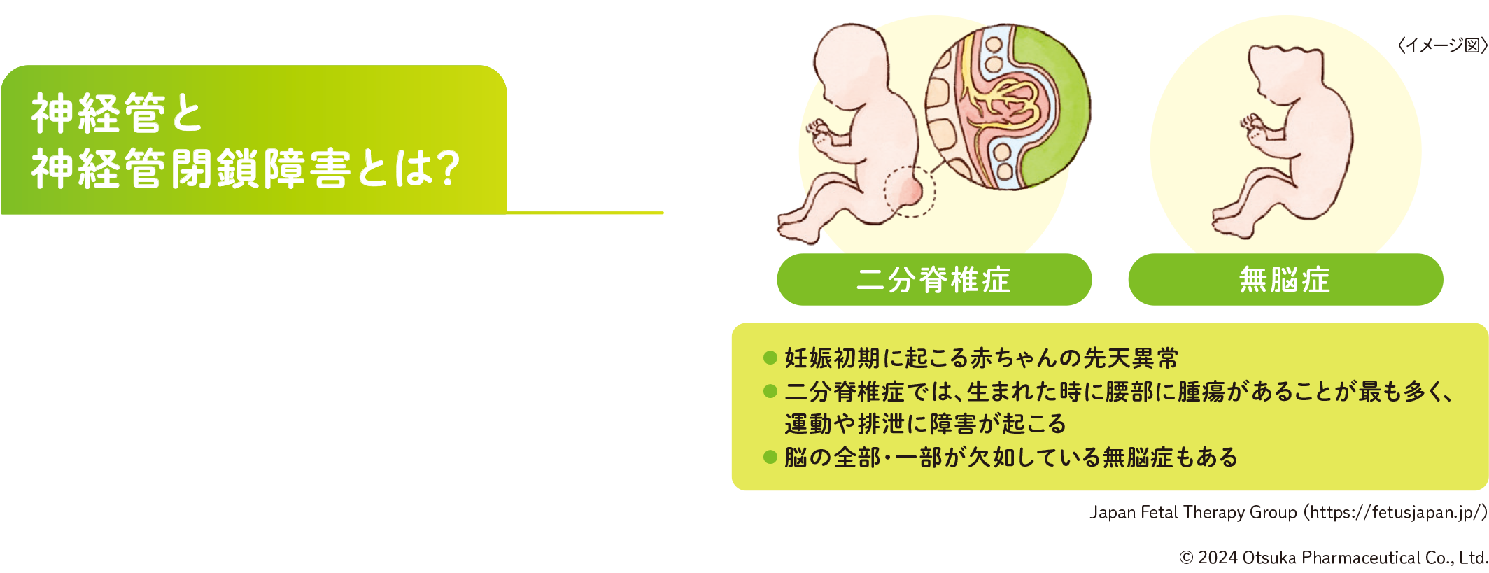 神経管と神経管閉鎖障害とは？